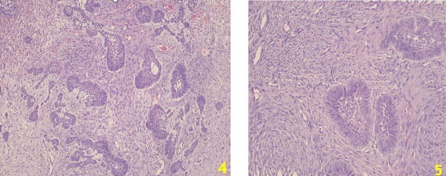 Genç Bir Kedide İnfiltratif Odontojenik-Ameloblastik Fibroma – görsel 4