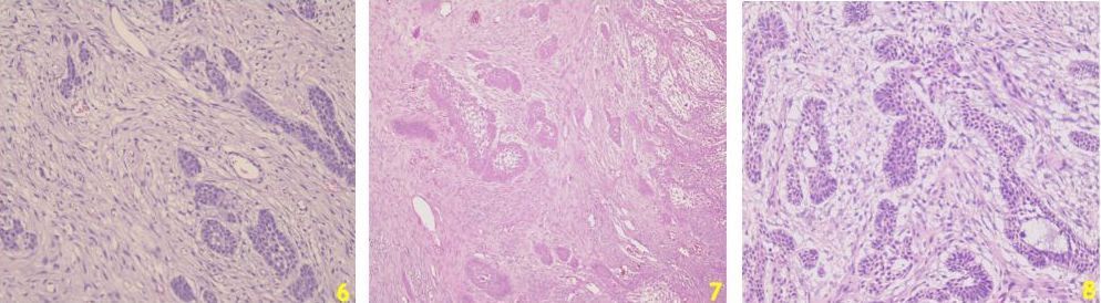 Genç Bir Kedide İnfiltratif Odontojenik-Ameloblastik Fibroma – görsel 5