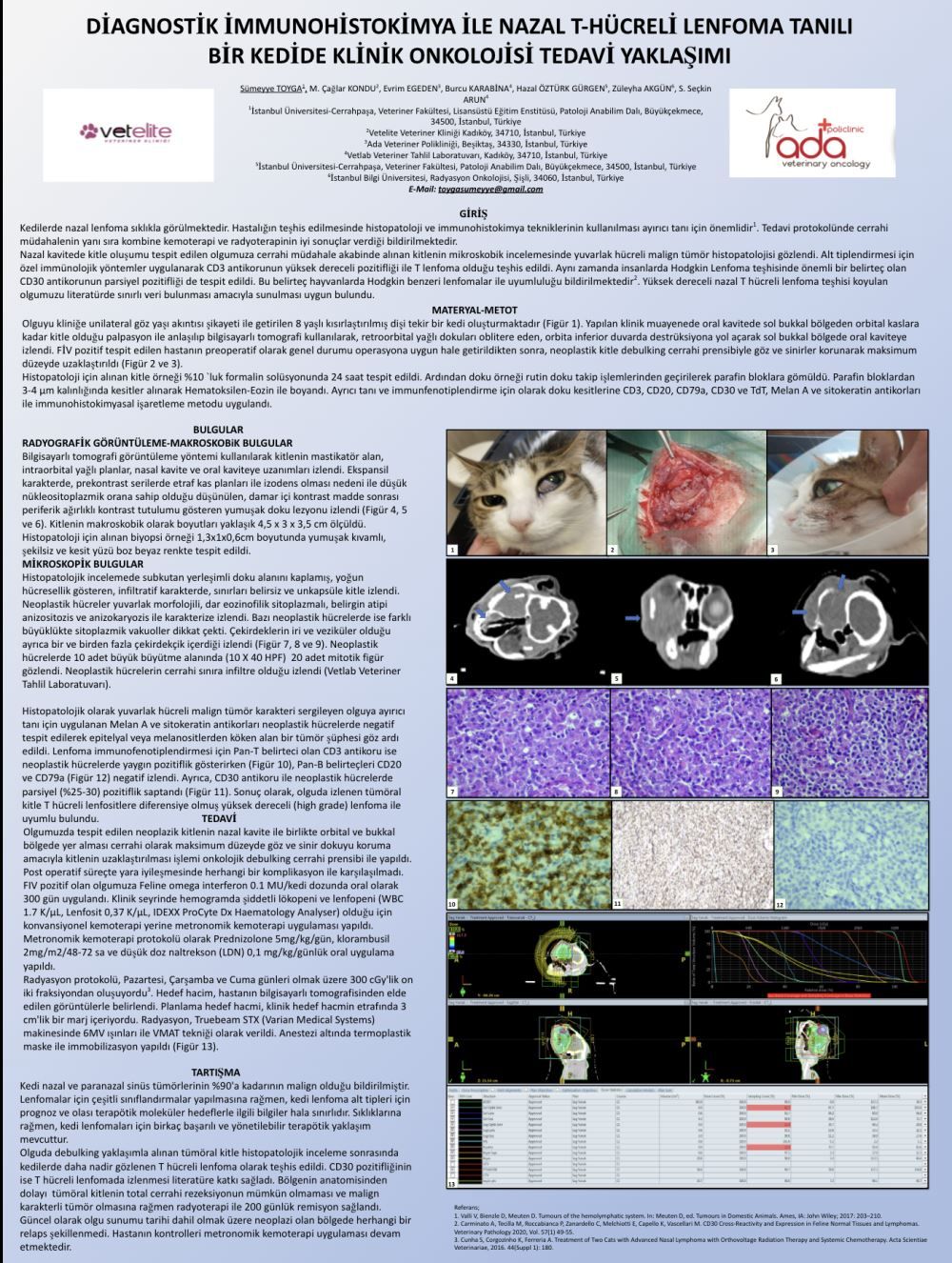 Diagnostik İmmunohistokimya Ile Nazal T-Hücreli Lenfoma – görsel 1