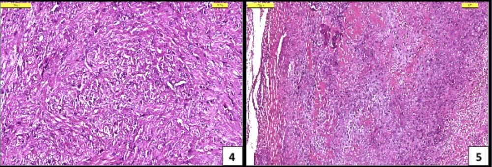 Apendiküler Osteosarkom Teşhisli Bir Köpekte Stereotaktik – görsel 3