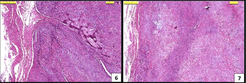 Apendiküler Osteosarkom Teşhisli Bir Köpekte Stereotaktik – görsel 4