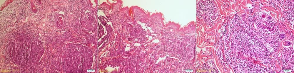 Bir Kedide Diffuz Tutulumlu Nonepiteliotropik Kutanöz – görsel 2
