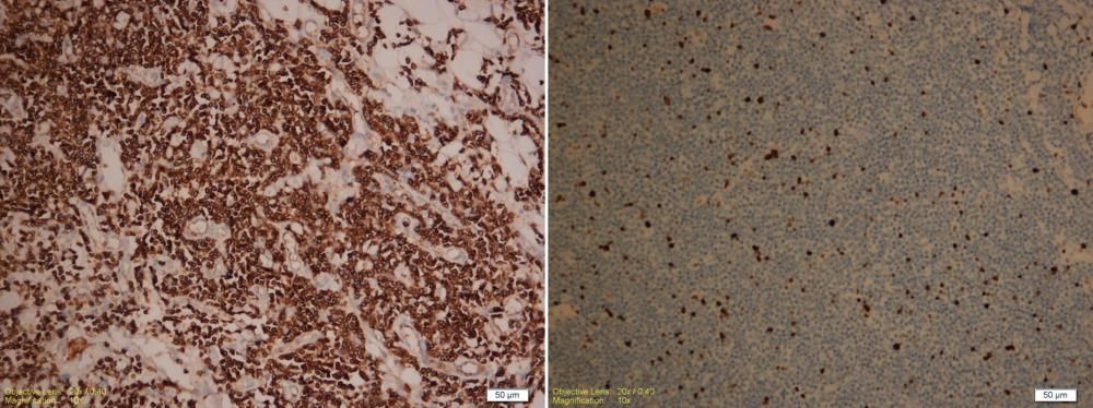 Bir Kedide Diffuz Tutulumlu Nonepiteliotropik Kutanöz – görsel 5