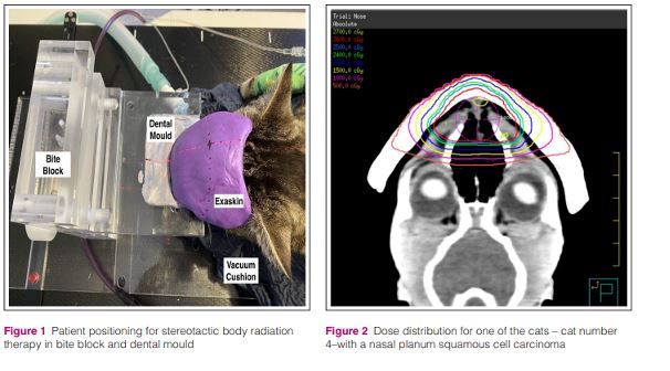 Figure 1 Bite-blok ve diş kalıbı içinde stereotaktik vücut radyasyon terapisi için hasta konumlandırması…
