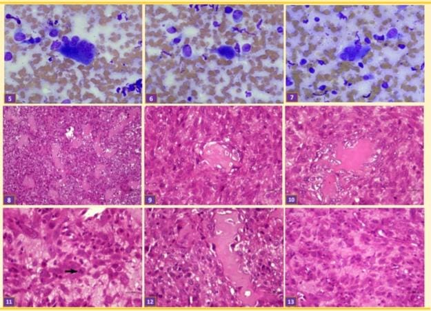 MANDİBULADA OSTEOSARKOM TEŞHİSLİ BİR KÖPEĞİN STEREOTAKTİK – görsel 2